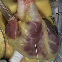Heart Beat - Atlas of Human Cardiac Anatomy